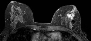 IRM image