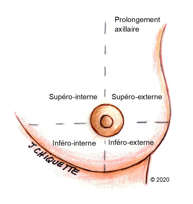 Quand faut il consulter pour un problèmes de seins? : symptômes,  traitement, définition 