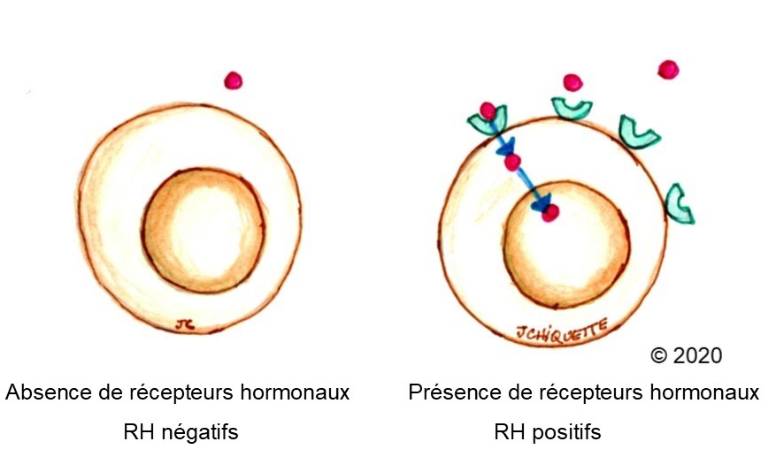 cancer hormonal infiltrant