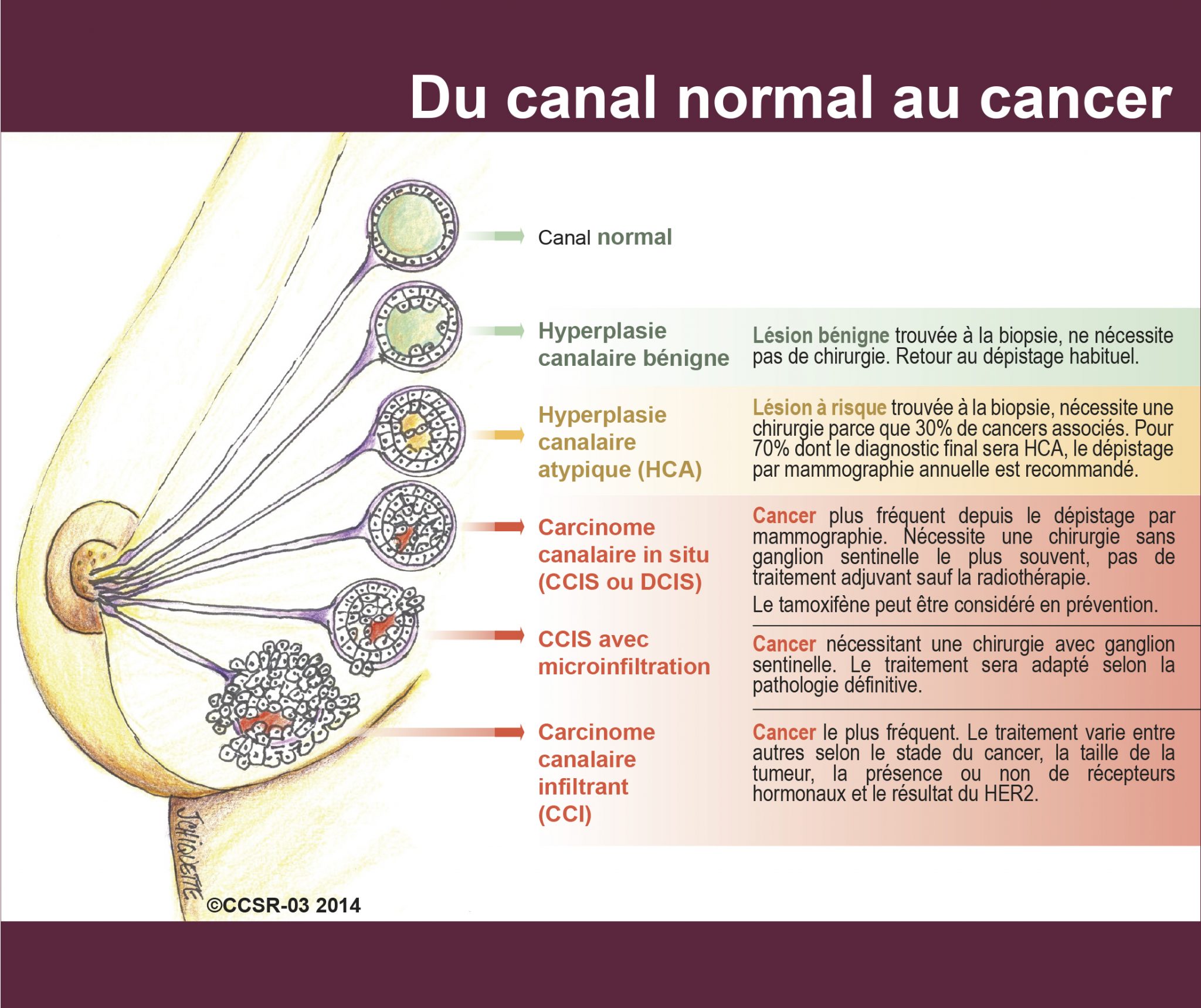 Programme québécois de dépistage du cancer du sein